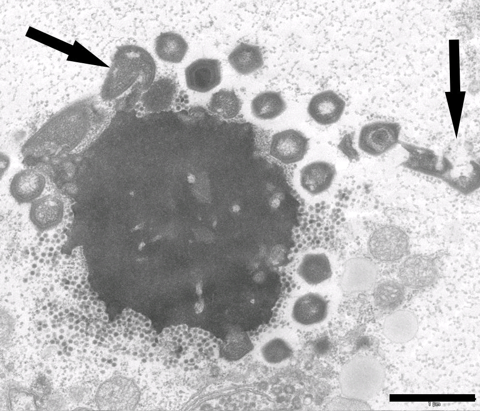 https://www.ncbi.nlm.nih.gov/pmc/articles/PMC3991649/figure/pone-0094923-g003/ Cropped from 
